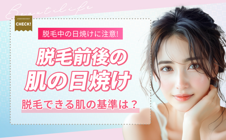脱毛中の日焼けはなぜダメ？理由・対策・日焼けしてしまった時の対処法